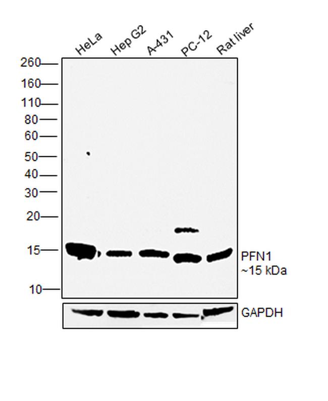 Profilin 1 Antibody in Western Blot (WB)