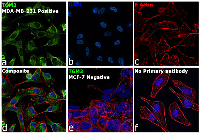 TGM2 Antibody in Immunocytochemistry (ICC/IF)