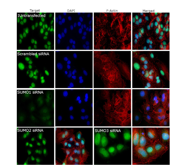 SUMO1 Antibody in Immunocytochemistry (ICC/IF)