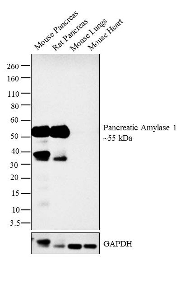 Pancreatic Amylase Antibody