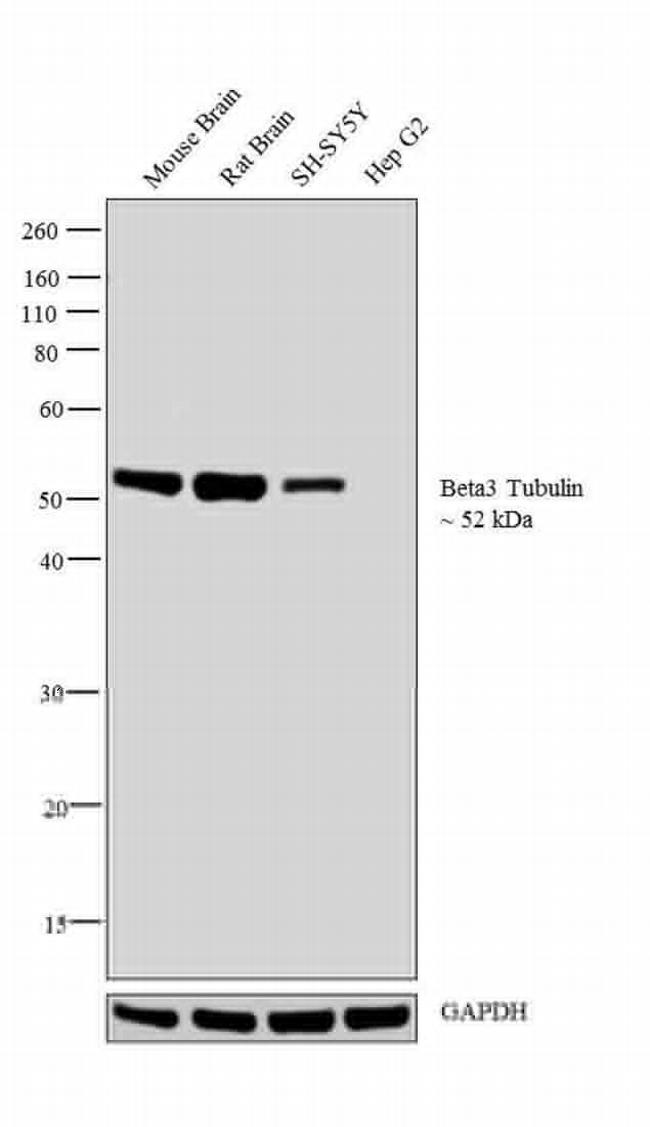 beta-3 Tubulin Antibody in Western Blot (WB)