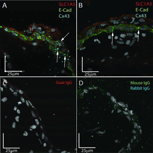 ASCT2 Antibody in Immunohistochemistry (IHC)