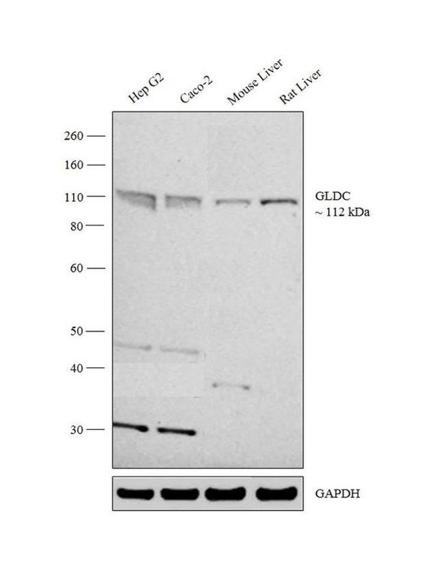 GLDC Antibody in Western Blot (WB)