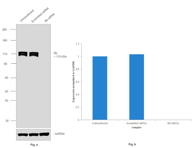 Rb Antibody