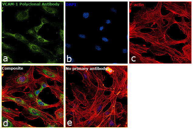 VCAM-1 Antibody in Immunocytochemistry (ICC/IF)