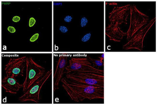 PARP1 Antibody in Immunocytochemistry (ICC/IF)