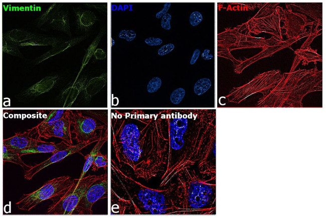 Vimentin Antibody in Immunocytochemistry (ICC/IF)