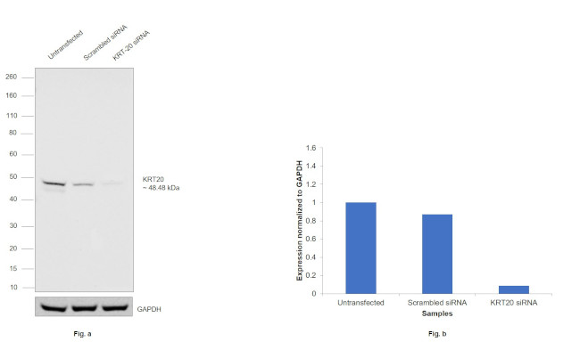 Cytokeratin 20 Antibody