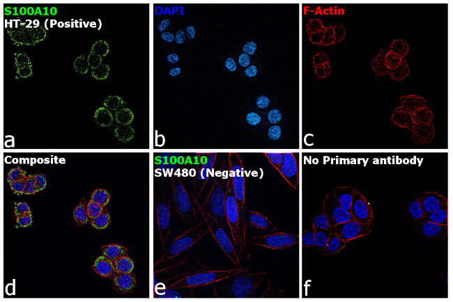 S100A10 Antibody