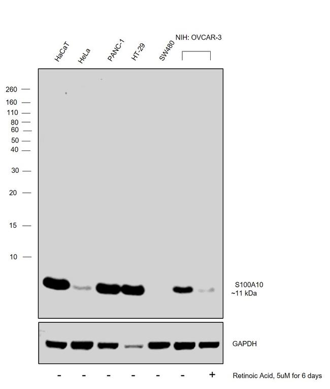 S100A10 Antibody in Western Blot (WB)