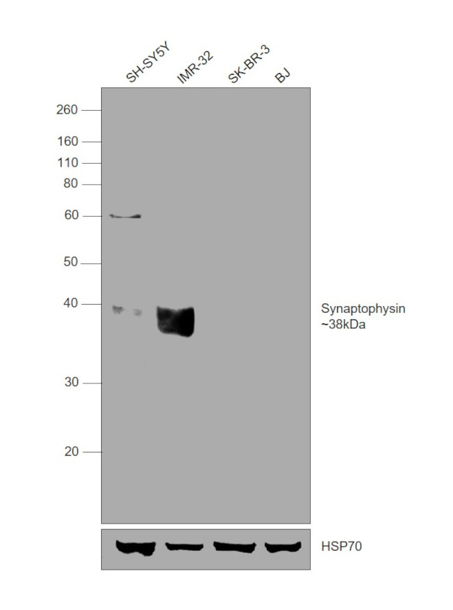 Synaptophysin Antibody