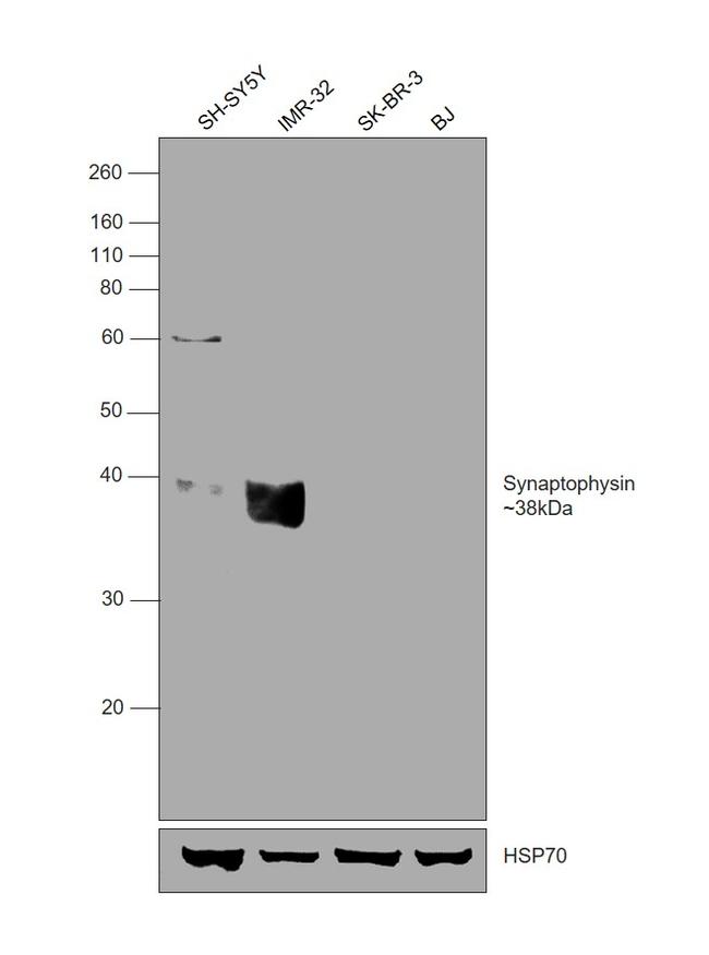 Synaptophysin Antibody in Western Blot (WB)