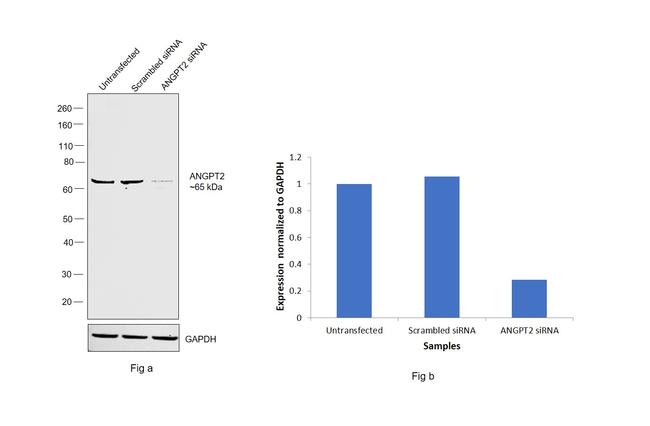 Angiopoietin 2 Antibody in Western Blot (WB)