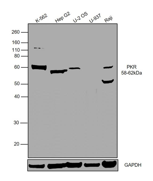 PKLR Antibody in Western Blot (WB)