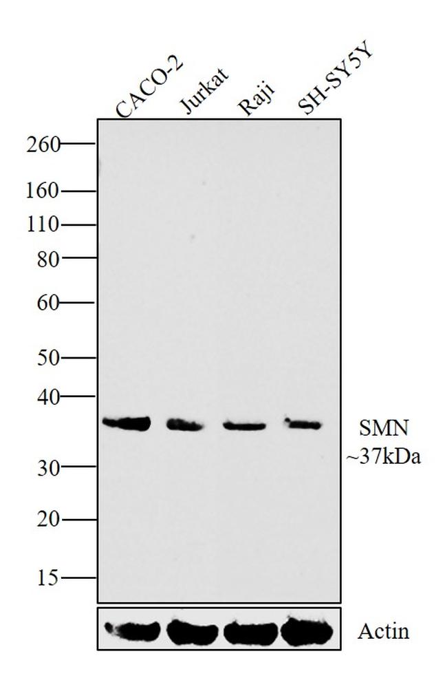 SMN1 Antibody in Western Blot (WB)