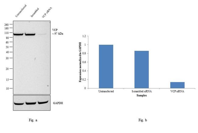 VCP Antibody in Western Blot (WB)