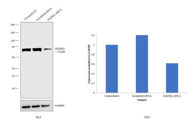 HADHA Antibody in Western Blot (WB)