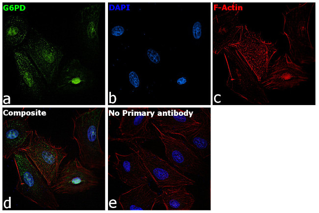 G6PD Antibody in Immunocytochemistry (ICC/IF)