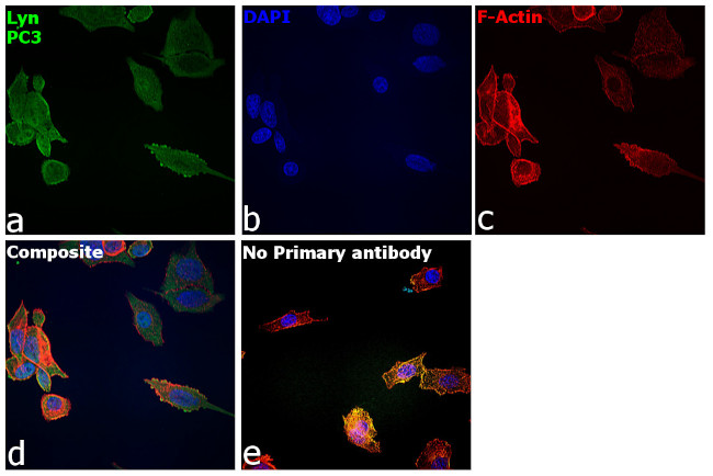 Lyn Antibody in Immunocytochemistry (ICC/IF)