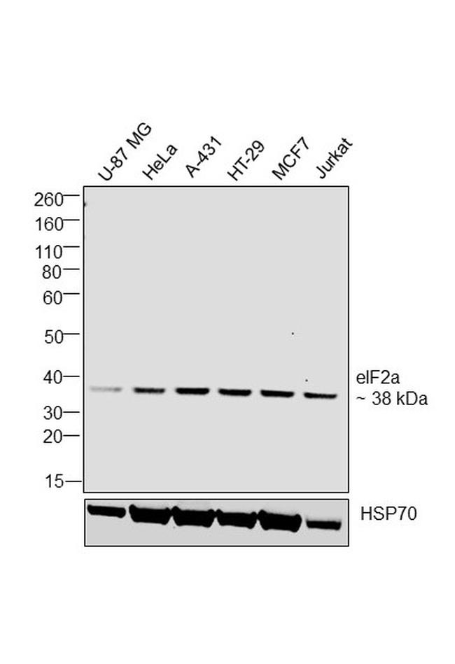 EIF2S1 Antibody in Western Blot (WB)