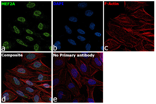 MEF2A Antibody in Immunocytochemistry (ICC/IF)