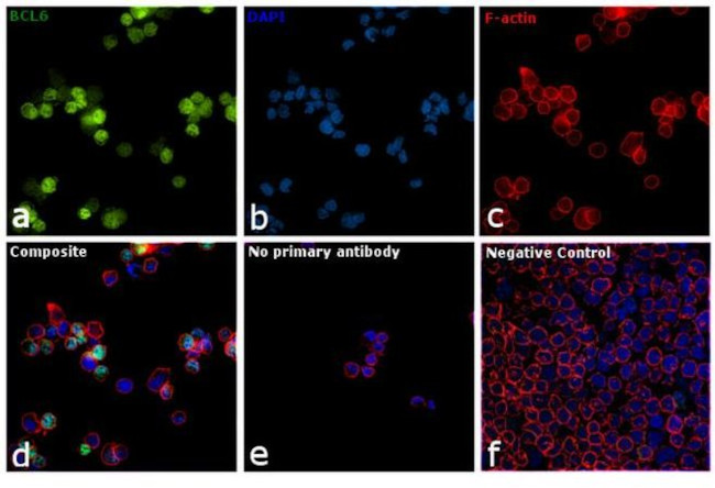 BCL6 Antibody in Immunocytochemistry (ICC/IF)