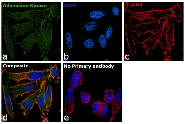 Adenosine Kinase Antibody in Immunocytochemistry (ICC/IF)