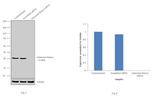 Adenosine Kinase Antibody in Western Blot (WB)