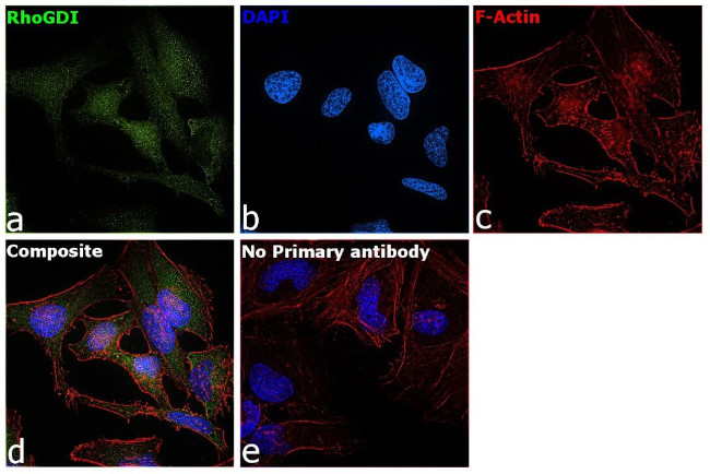 RhoGDI Antibody in Immunocytochemistry (ICC/IF)