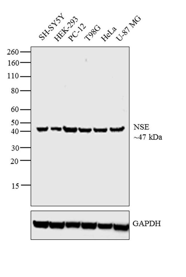 NSE Antibody in Western Blot (WB)