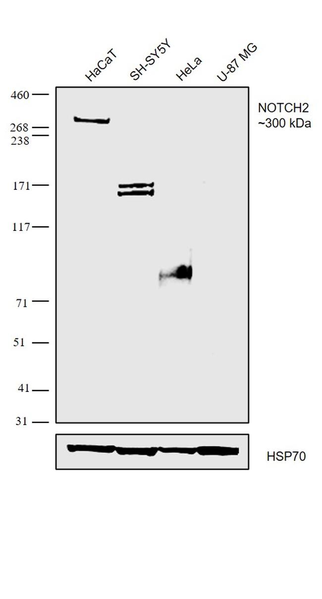 NOTCH2 Antibody in Western Blot (WB)