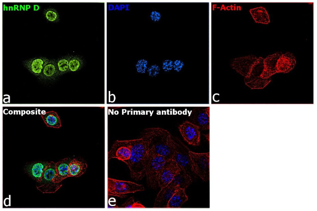 hnRNP D Antibody in Immunocytochemistry (ICC/IF)