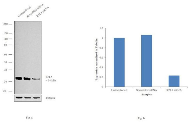 RPL5 Antibody