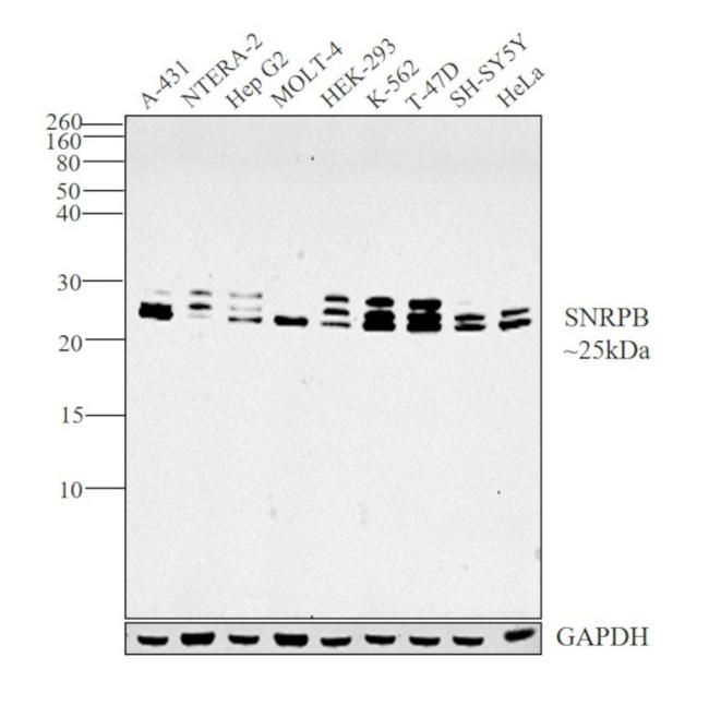 SNRPB Antibody in Western Blot (WB)