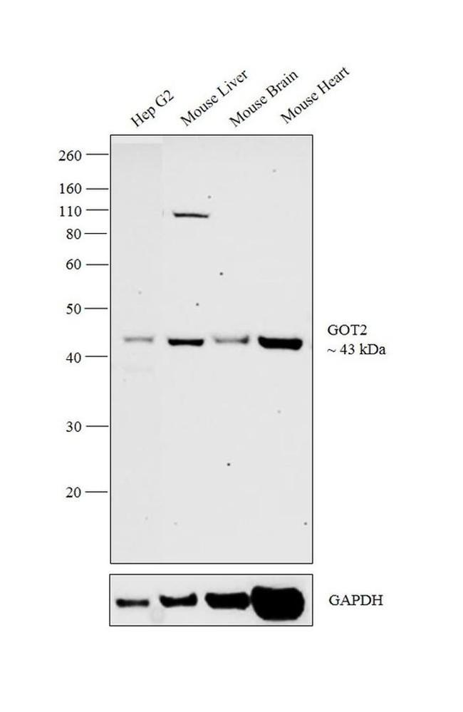 GOT2 Antibody in Western Blot (WB)