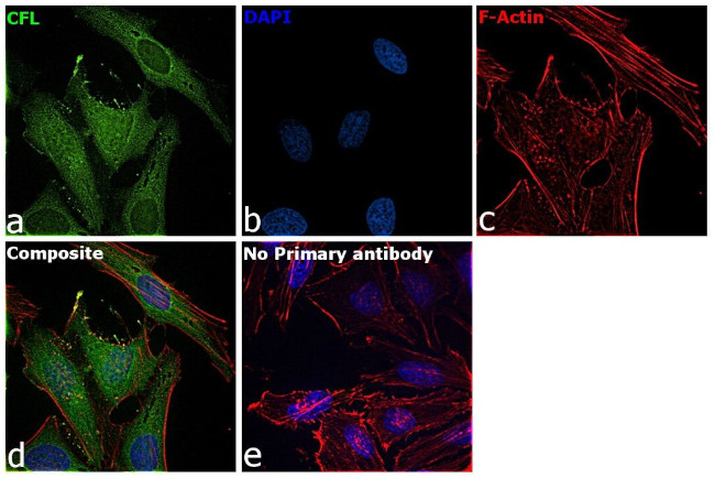 Cofilin Antibody in Immunocytochemistry (ICC/IF)