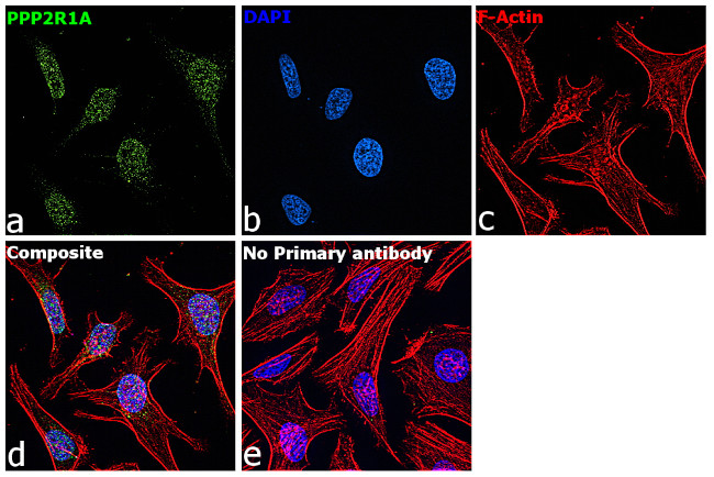 PPP2R1A Antibody in Immunocytochemistry (ICC/IF)