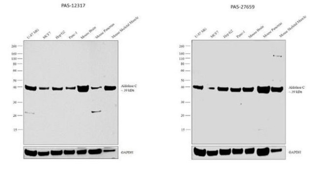 Aldolase C Antibody