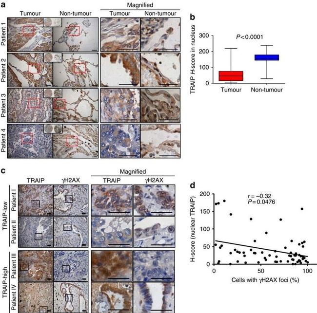 TRIP Antibody in Immunohistochemistry (IHC)