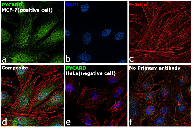 PYCARD Antibody in Immunocytochemistry (ICC/IF)