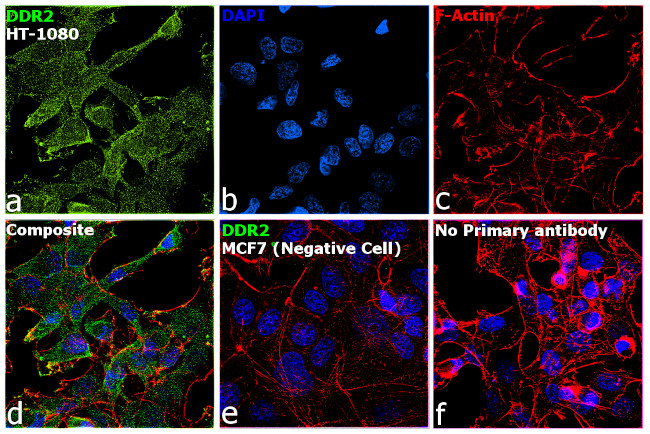 DDR2 Antibody in Immunocytochemistry (ICC/IF)