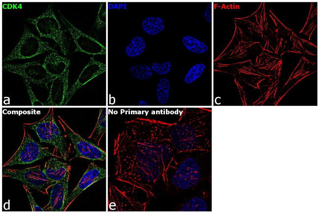 CDK4 Antibody in Immunocytochemistry (ICC/IF)