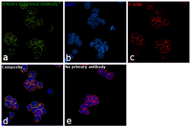 IFNGR1 Antibody in Immunocytochemistry (ICC/IF)