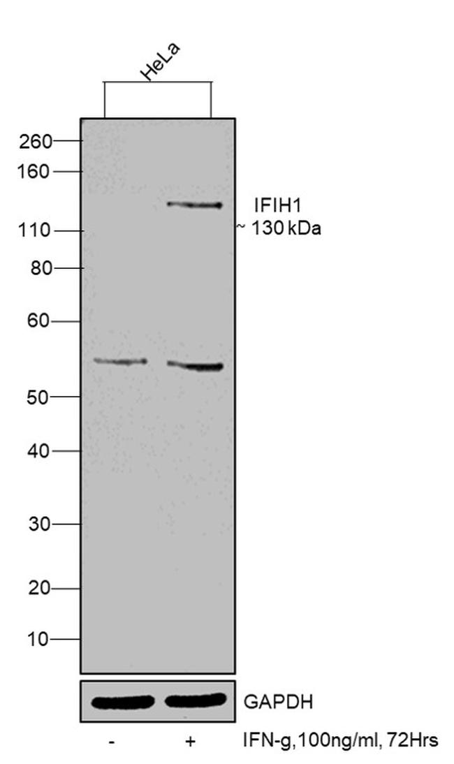 MDA5 Antibody in Western Blot (WB)