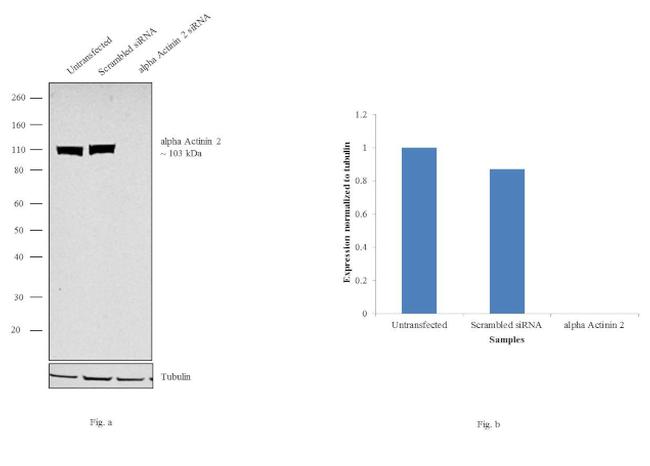 alpha Actinin 2 Antibody in Western Blot (WB)