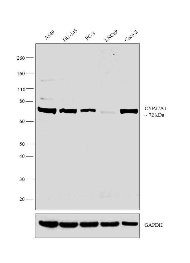 CYP27A1 Antibody in Western Blot (WB)