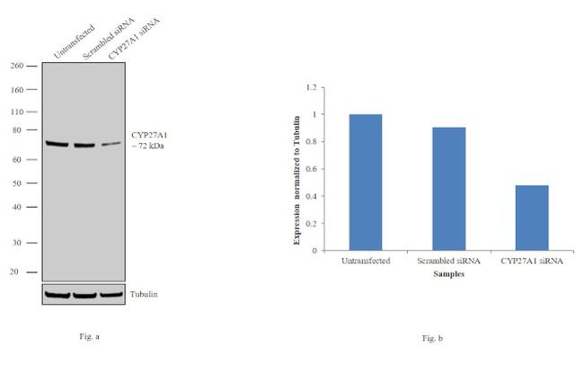 CYP27A1 Antibody in Western Blot (WB)