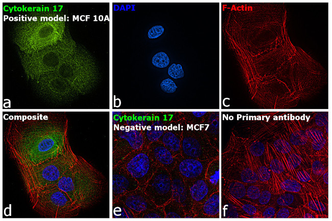 Cytokeratin 17 Antibody