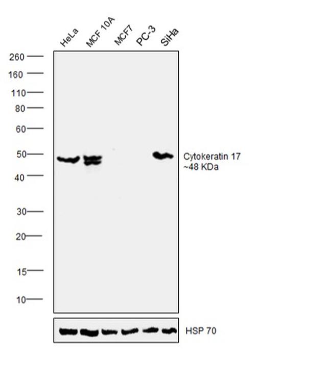 Cytokeratin 17 Antibody in Western Blot (WB)