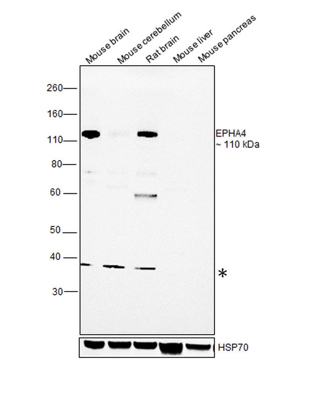 EphA4 Antibody in Western Blot (WB)